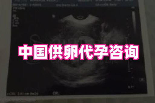 长春助孕网 4